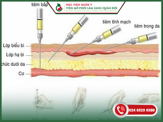 Tiêm Lovenox đến tuần bao nhiều của thai kỳ