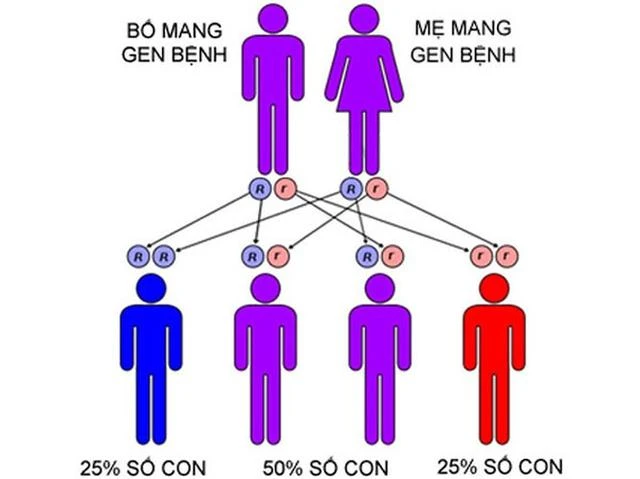 Bệnh teo cơ tủy sống là do di truyền