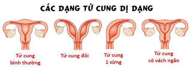 20191213 100932 957044 Di dang tu cung.max 1800x1800 1