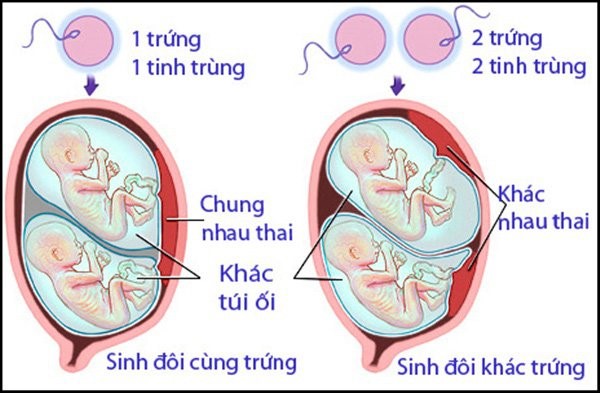 song thai 011