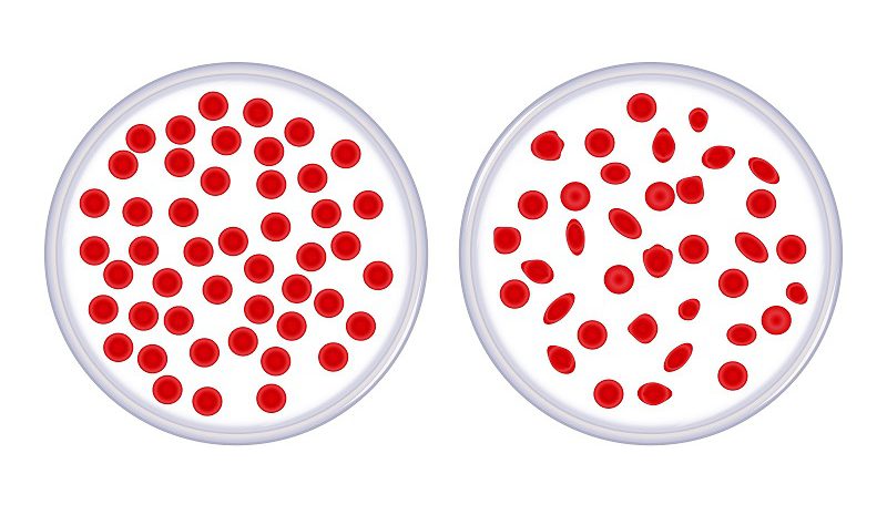 thalassemia gentis 8 2020 5