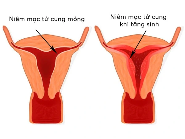 niemmactucungmong 20181128094302