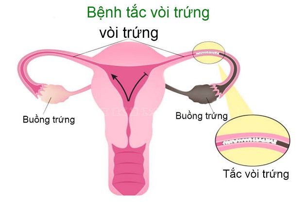 tac voi trung 2