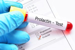 20200527 prolactin 1 2