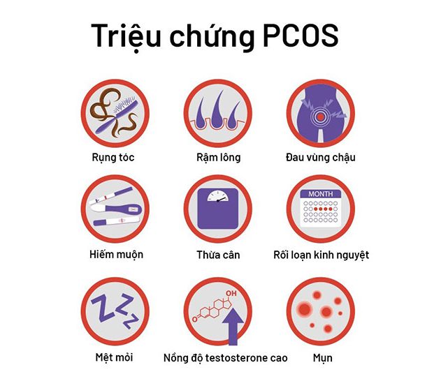 trieu chung pcos