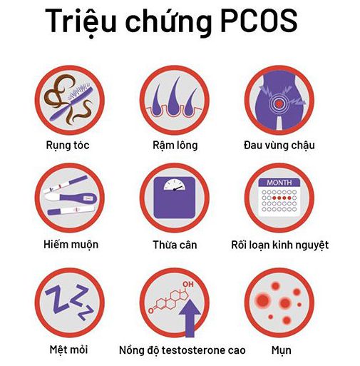 trieu chung pcos trieu chung pcos