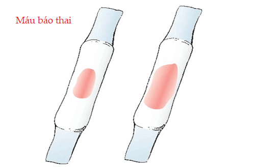 mau bao thai 1