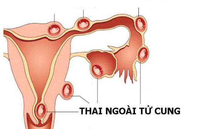 20191120110445501092thai ngoai tu cungmax 800x800 16291708028201647394866.jpg