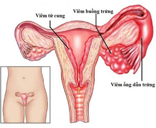 5dcf6f9399141dea3d3a3c98 viem buong trung la gi