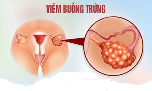 benhbuongtrung5