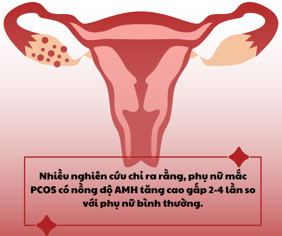 Nhiều nghiên cứu chỉ ra rằng, phụ nữ mắc PCOS có nồng độ AMH tăng cao gấp 2 4 lần so với phụ nữ bình thường. Nhiều nghiên cứu chỉ ra rằng, phụ nữ mắc PCOS có nồng độ AMH tăng cao gấp 2 4 lần so với phụ nữ bình thường.