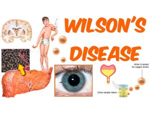 Wilson