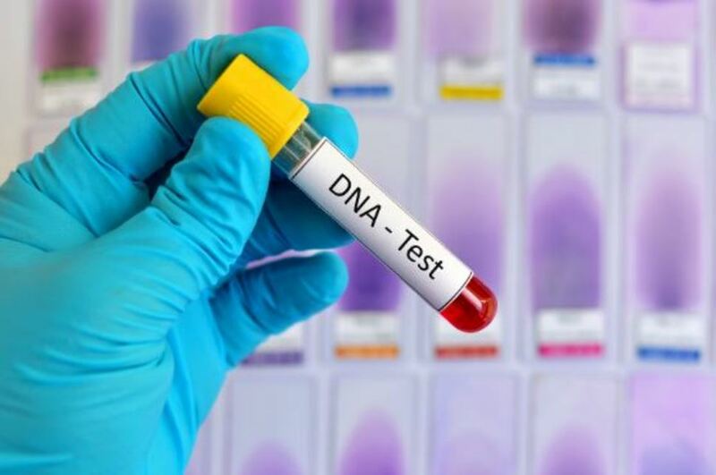 DNA