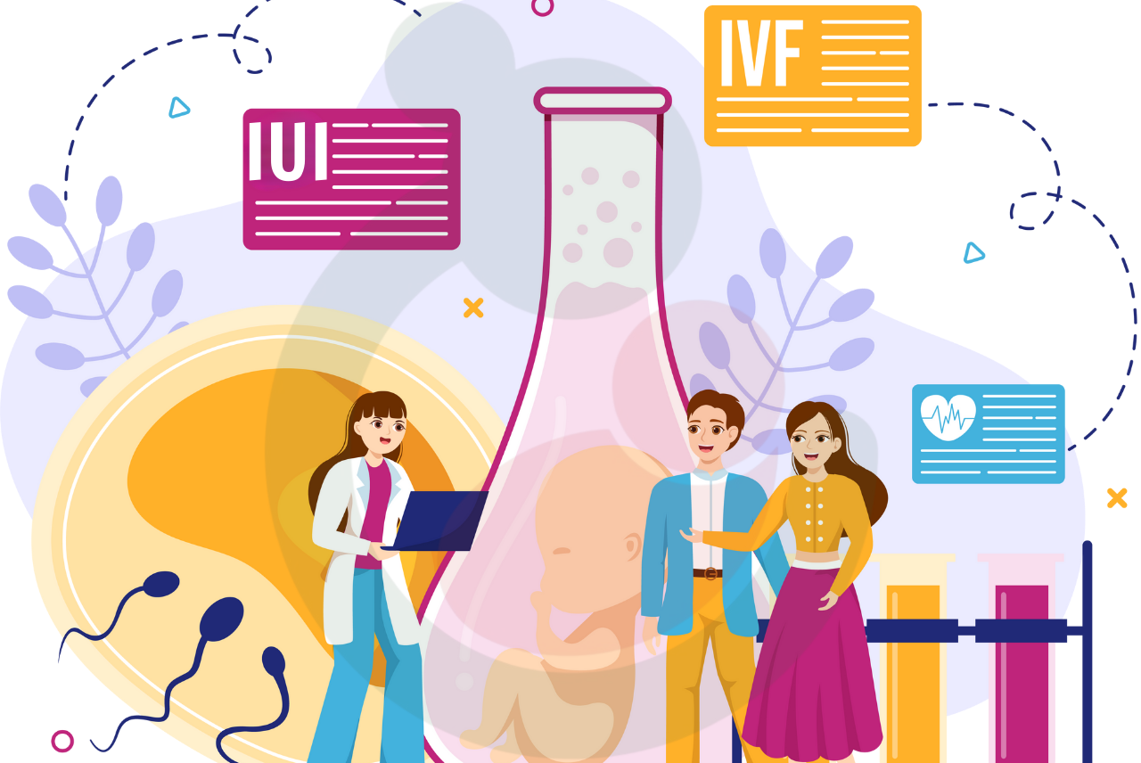 IVFIUI