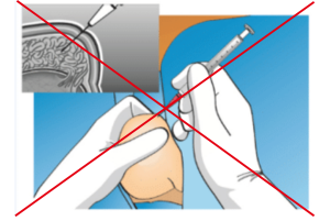 Chống chỉ định pesa