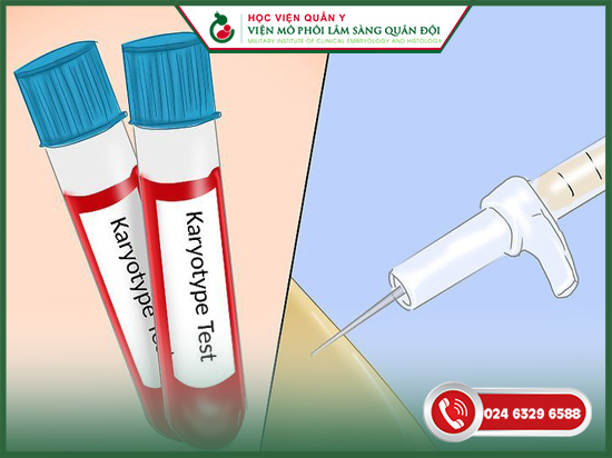 xét nghiệm karyotype