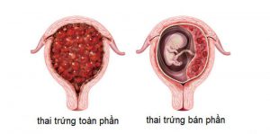 20220919 chua trung ban phan