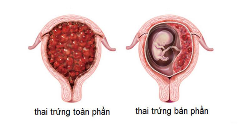 20220919 chua trung ban phan