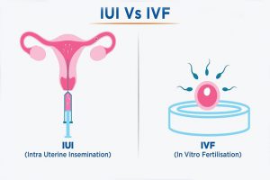 184997 iui va ivf