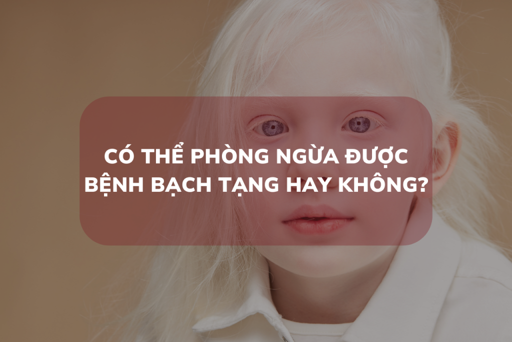 Có thể phòng ngừa được bệnh bạch tạng không?